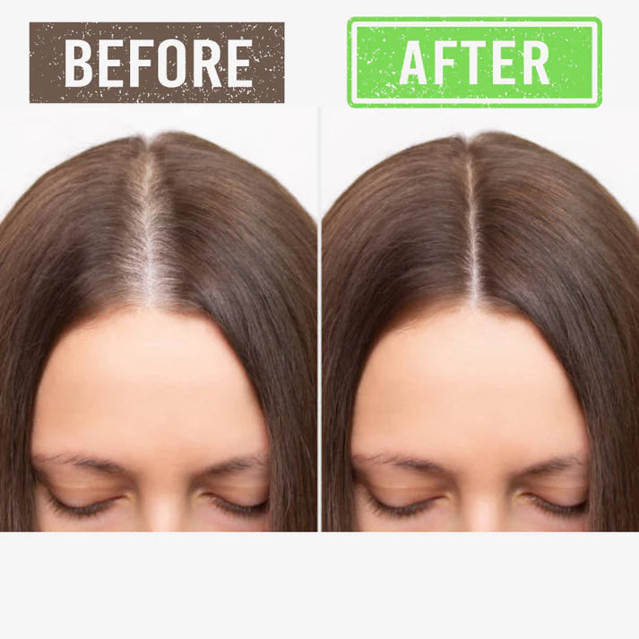 Scalp Serum - Hair Growth Solution