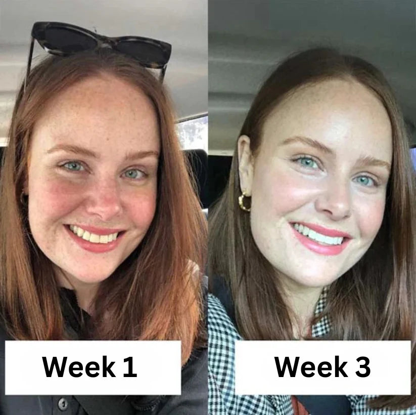 White™ - 100% Organic Spearmint Oil Pulling