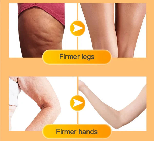 Anti Cellulite Massage Oil