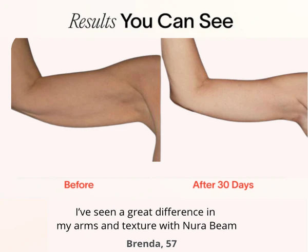 NuraSculpt™ Red Light Bands