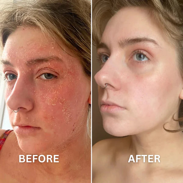 Anti-aging Glow Gummies
