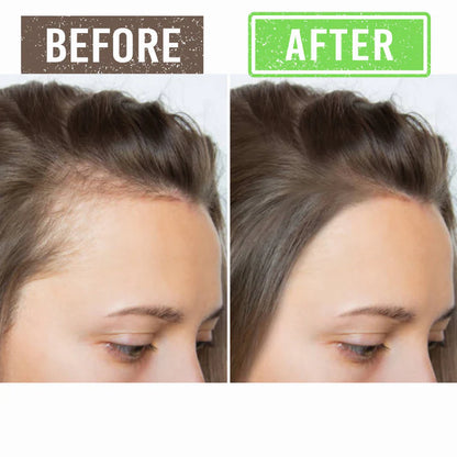 Scalp Serum - Hair Growth Solution
