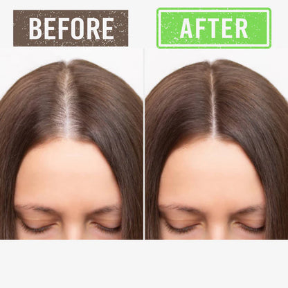 Scalp Serum - Hair Growth Solution